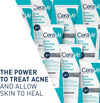 CERAVE Acne Foaming Cream Cleanser