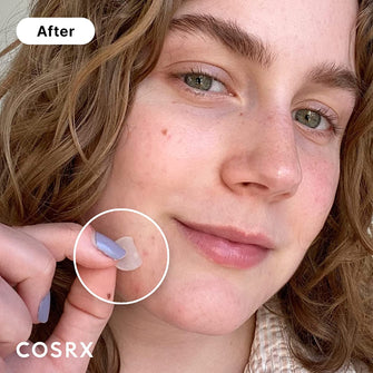 COSRX - Acne Pimple Master PatchCOSRX - Acne Pimple Master PatchGlam Secret