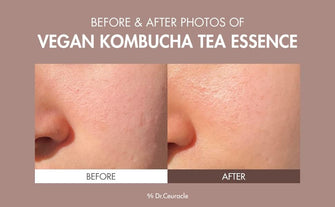 Dr.Ceuracle Vegan Kombucha Tea Essence - 150mlessenceGlam Secret
